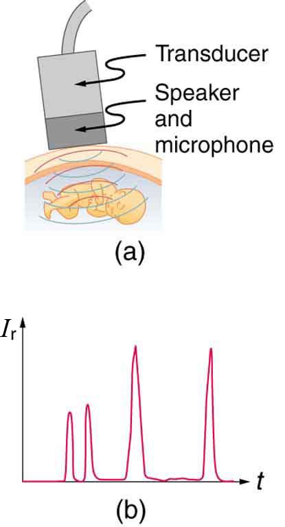 The first part of the diagram shows a rectangular shaped transducer with speaker and microphone sending spherical waves to produce echos from a fetus. The second part shows a graph of echo intensity versus time, with four sharp peaks.