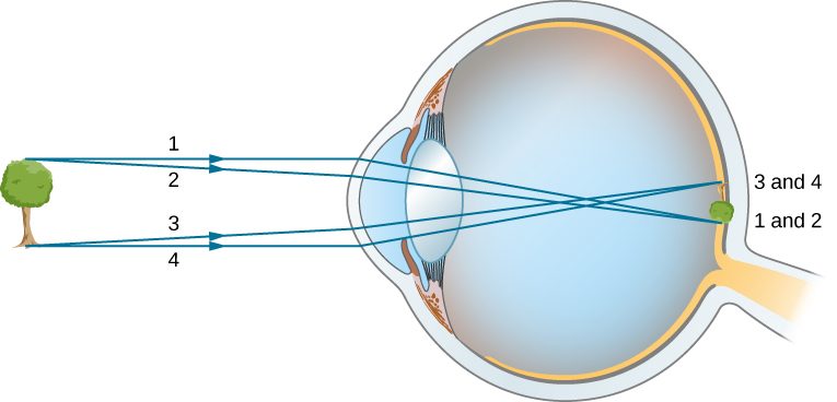 Figure shows a tree in front of an eye. Rays from the top and bottom of the tree strike the cornea of the eye. They are refracted, intersect in the middle of the vitreous humor and reach the retina. The image formed on the retina is tiny and inverted.